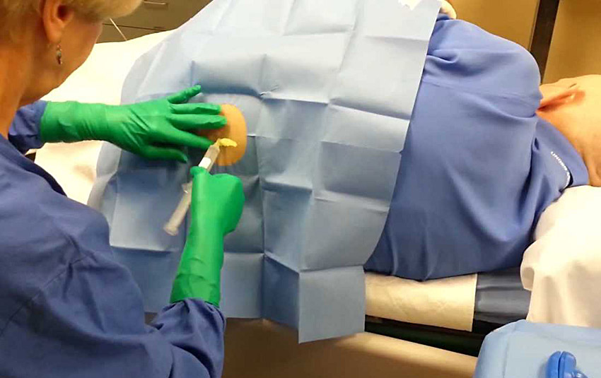 Bone Marrow Procedure Compassionate Oncologist Hematologist Cancer Treatment Center NJ